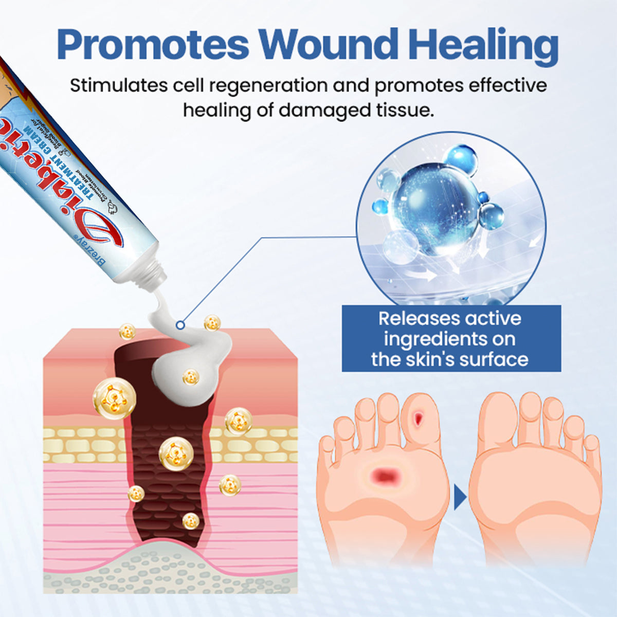 ⏰Limited Stock🔥Flash Sale 70% OFF🔥Brezray® VitaGluco Diabetes Treatment Cream