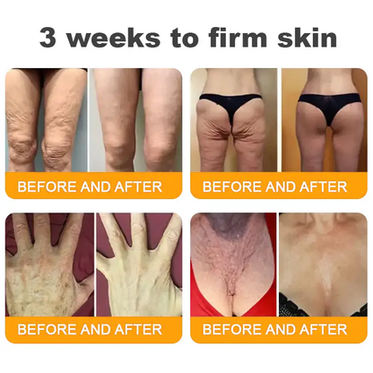 LOVILDS™ Bee Venom Cream – 🌸 Anti-Aging, Hydrating & Skin Repair